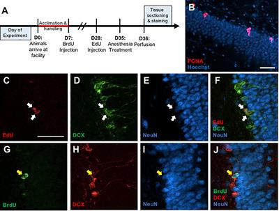 The Effects of Anesthesia on Adult Hippocampal Neurogenesis